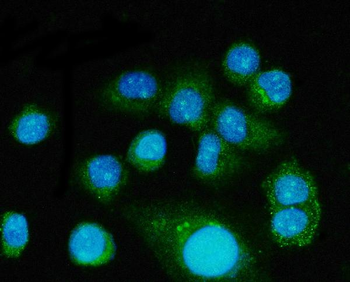 FGF2 Rabbit Polyclonal Antibody