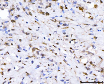 FGF2 Rabbit Polyclonal Antibody