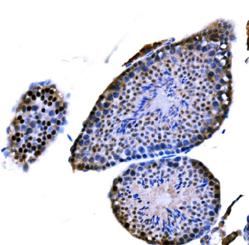 DMC1 Rabbit Polyclonal Antibody