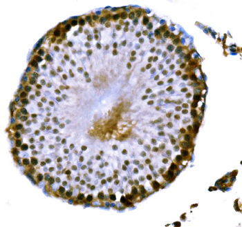 DMC1 Rabbit Polyclonal Antibody
