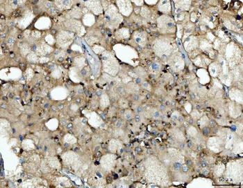 Cathepsin B/CTSB Rabbit Polyclonal Antibody