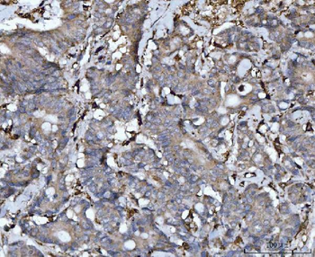 Cathepsin B/CTSB Rabbit Polyclonal Antibody