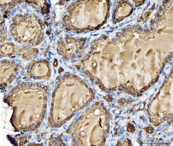 Cathepsin B/CTSB Rabbit Polyclonal Antibody