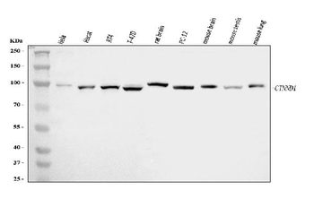 delta 1 Catenin/CAS/CTNND1 Rabbit Polyclonal Antibody