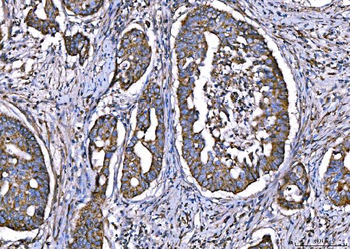 CPT1A Rabbit Polyclonal Antibody