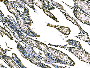 Claudin18/CLDN18 Rabbit Polyclonal Antibody