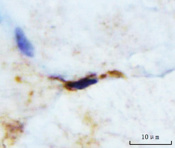 M Cadherin/CDH15 Rabbit Polyclonal Antibody