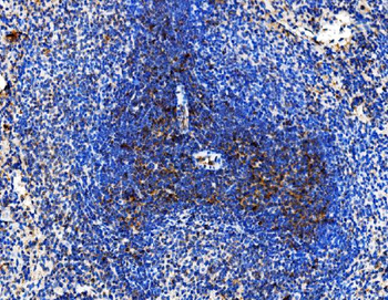 Cd86 Rabbit Polyclonal Antibody