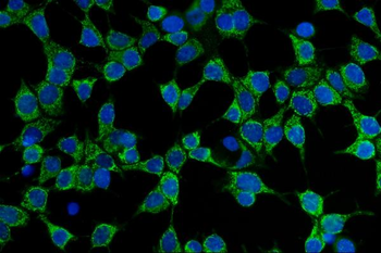 CD86 Rabbit Polyclonal Antibody
