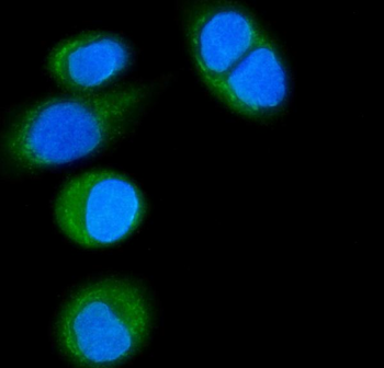 CD14 Rabbit Polyclonal Antibody