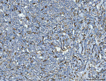 CD14 Rabbit Polyclonal Antibody