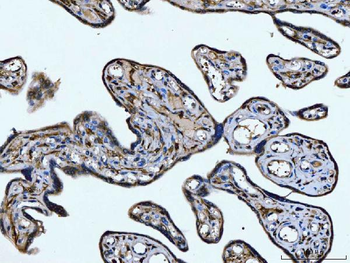 CD14 Rabbit Polyclonal Antibody