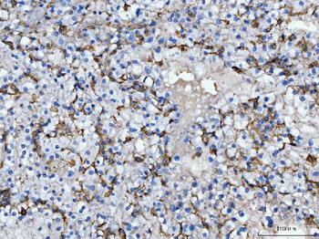 CD14 Rabbit Polyclonal Antibody