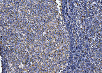 CD14 Rabbit Polyclonal Antibody