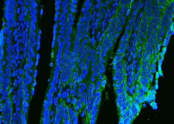 CD9 Rabbit Polyclonal Antibody