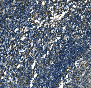 ATP6V1A Rabbit Polyclonal Antibody
