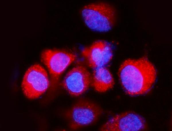 ATP6V1A Rabbit Polyclonal Antibody