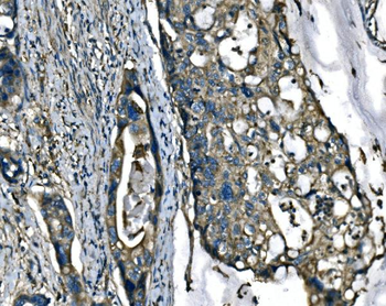 ATP6V1A Rabbit Polyclonal Antibody