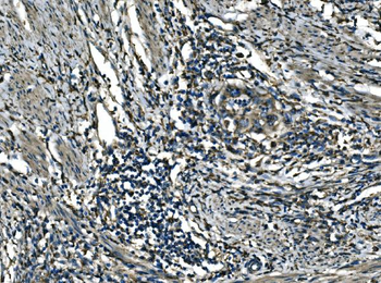 ATP6V1A Rabbit Polyclonal Antibody