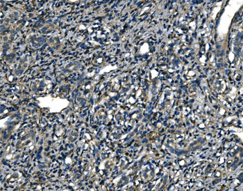 ATP6V1A Rabbit Polyclonal Antibody