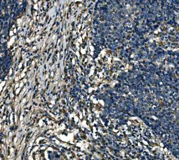 ATP6V1A Rabbit Polyclonal Antibody