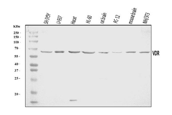 Vitamin D Receptor/VDR Rabbit Polyclonal Antibody