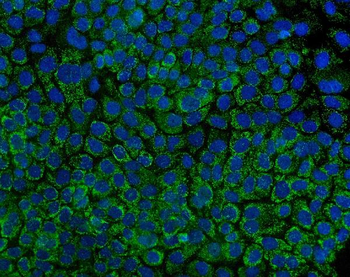 Tryptophan Hydroxylase/TPH1 Rabbit Polyclonal Antibody