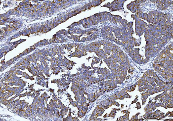 Tryptophan Hydroxylase/TPH1 Rabbit Polyclonal Antibody