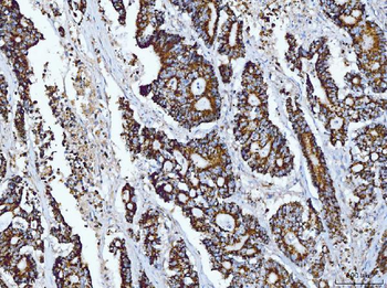 Tryptophan Hydroxylase/TPH1 Rabbit Polyclonal Antibody