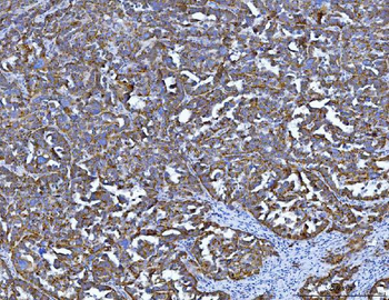 Tryptophan Hydroxylase/TPH1 Rabbit Polyclonal Antibody