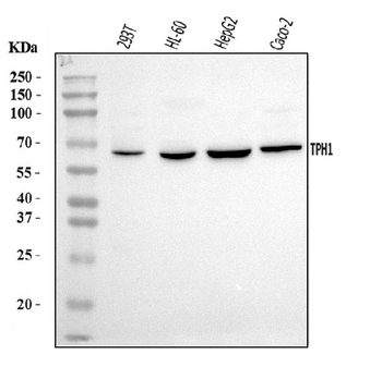 Tryptophan Hydroxylase/TPH1 Rabbit Polyclonal Antibody