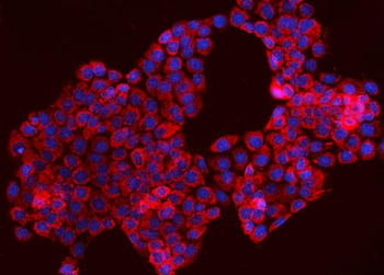 TOMM70 Rabbit Polyclonal Antibody