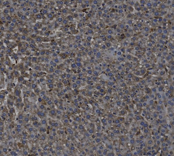 TGF beta 1/TGFB1 Rabbit Polyclonal Antibody