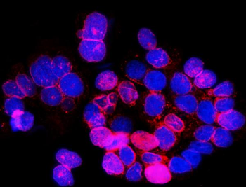 SUN2 Rabbit Polyclonal Antibody