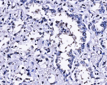 SUN2 Rabbit Polyclonal Antibody