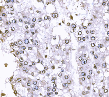 SUN2 Rabbit Polyclonal Antibody