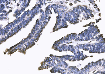 SUN2 Rabbit Polyclonal Antibody