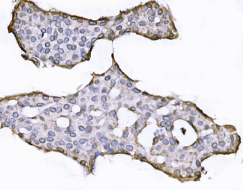 SUN2 Rabbit Polyclonal Antibody