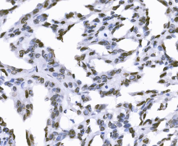 SUN2 Rabbit Polyclonal Antibody