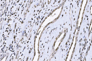SUN2 Rabbit Polyclonal Antibody