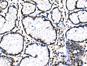 RAD18 Rabbit Polyclonal Antibody