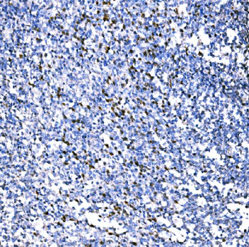 RAD18 Rabbit Polyclonal Antibody