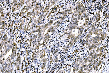 RAD18 Rabbit Polyclonal Antibody