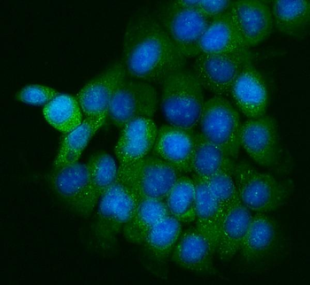 PPFIA1 Rabbit Polyclonal Antibody