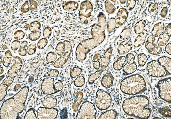 PPFIA1 Rabbit Polyclonal Antibody