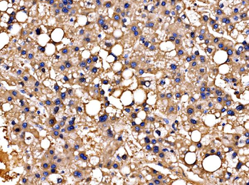 PPFIA1 Rabbit Polyclonal Antibody