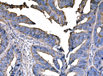 PPFIA1 Rabbit Polyclonal Antibody