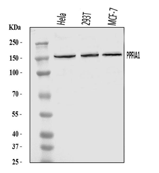 PPFIA1 Rabbit Polyclonal Antibody