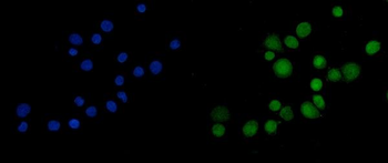 Mkl1/MRTFA Rabbit Polyclonal Antibody