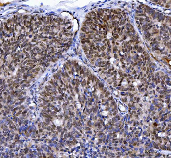 MLH1 Rabbit Polyclonal Antibody